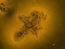 Mikrobiologiczna mgławica